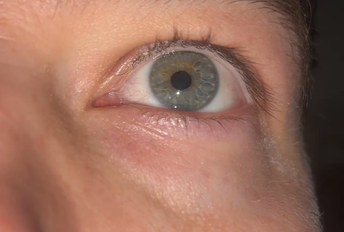 Phone positioning for eye-tracking